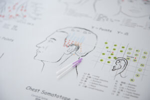 鍼灸院でのシェーマ